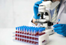 Scientist using a microscope with blood samples in tubes
