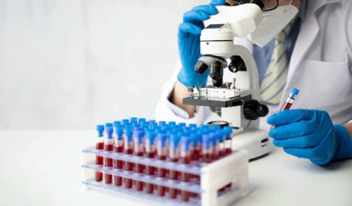 Scientist using a microscope with blood samples in tubes