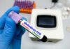 Plague Alert Hits Santa Fe A hand holding a blood sample tube labeled Melioidosis PCR Positive with laboratory equipment in the background