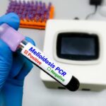 A hand holding a blood sample tube labeled Melioidosis PCR Positive with laboratory equipment in the background