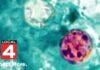 Michigan cyclosporiasis outbreak grows to 700 reported cases