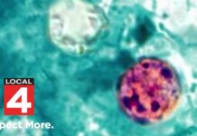 Parasite Panic Slams Michigan Produce Michigan cyclosporiasis outbreak grows to 700 reported cases