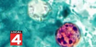 Michigan cyclosporiasis outbreak grows to 700 reported cases